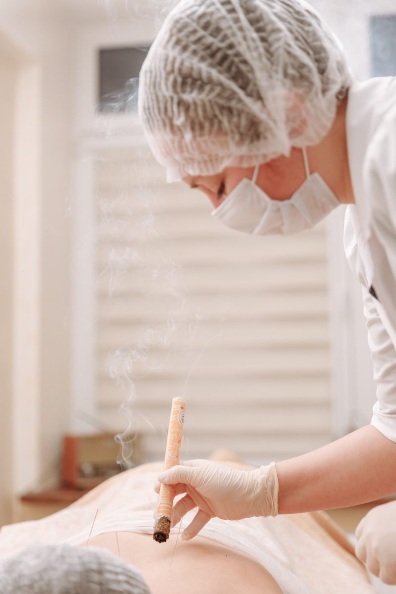 woman getting acupuncture
